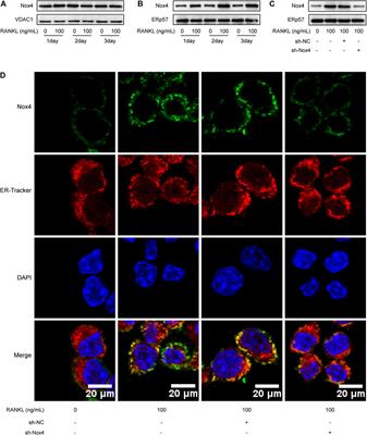 Nox4 Promotes RANKL-Induced Autophagy and Osteoclastogenesis via Activating ROS/PERK/eIF-2α/ATF4 Pathway